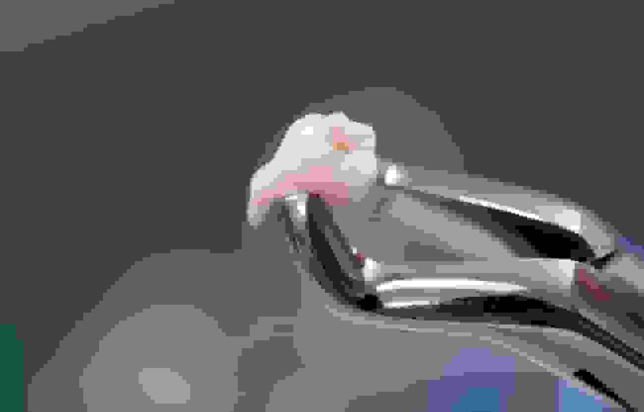 تبدیل سلول‌های بنیادی دندان به نورون: راهی برای درمان آلزایمر و هانتینگتون