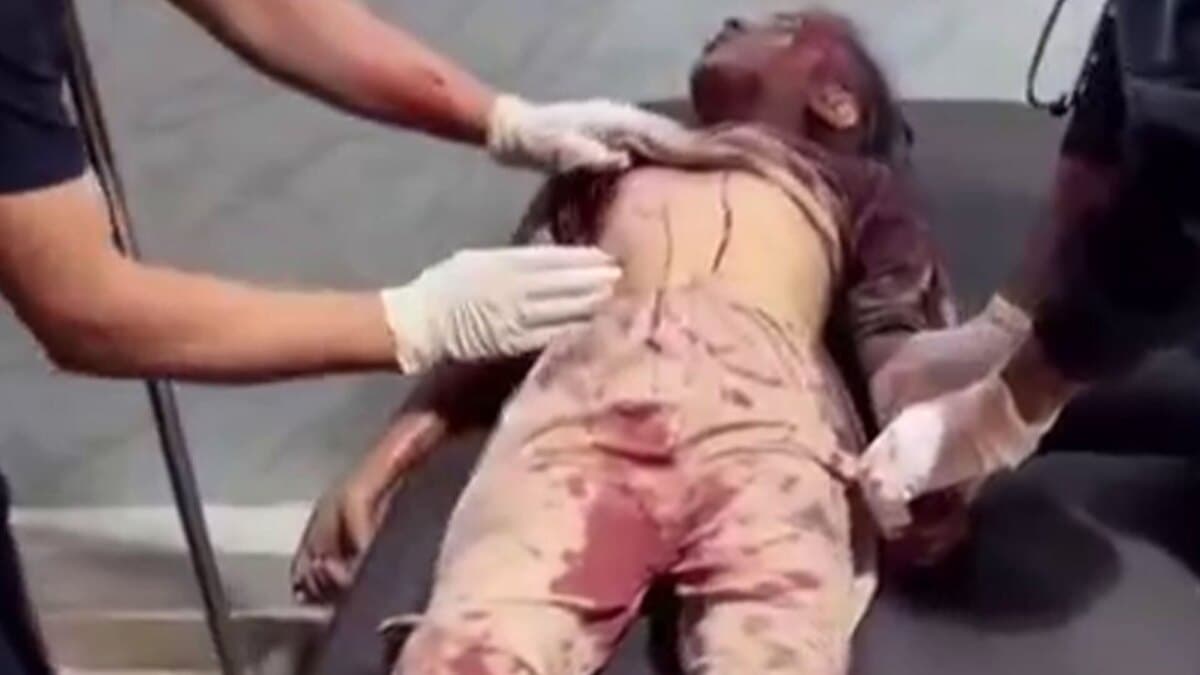 شهادت و زخمی شدن کودکان در حمله اسرائیل به مدرسه در غزه