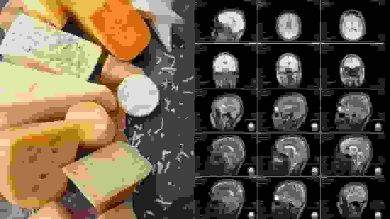 مطالعه جدید: مصرف هفتگی پنیر کاهش خطر زوال عقل